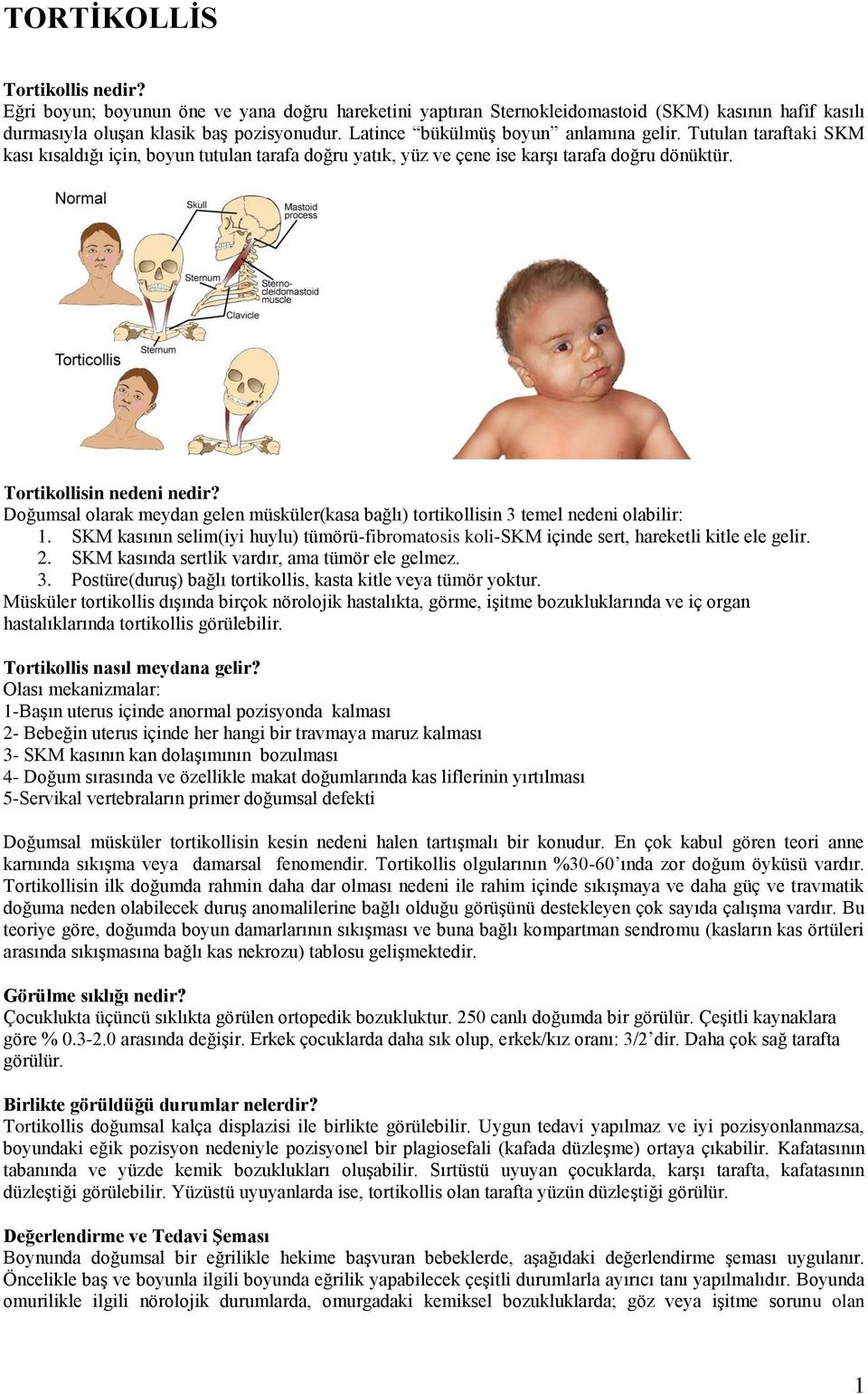 Doğumsal olarak meydan gelen müsküler(kasa bağlı) tortikollisin 3 temel nedeni olabilir: 1. SKM kasının selim(iyi huylu) tümörü-fibromatosis koli-skm içinde sert, hareketli kitle ele gelir. 2.