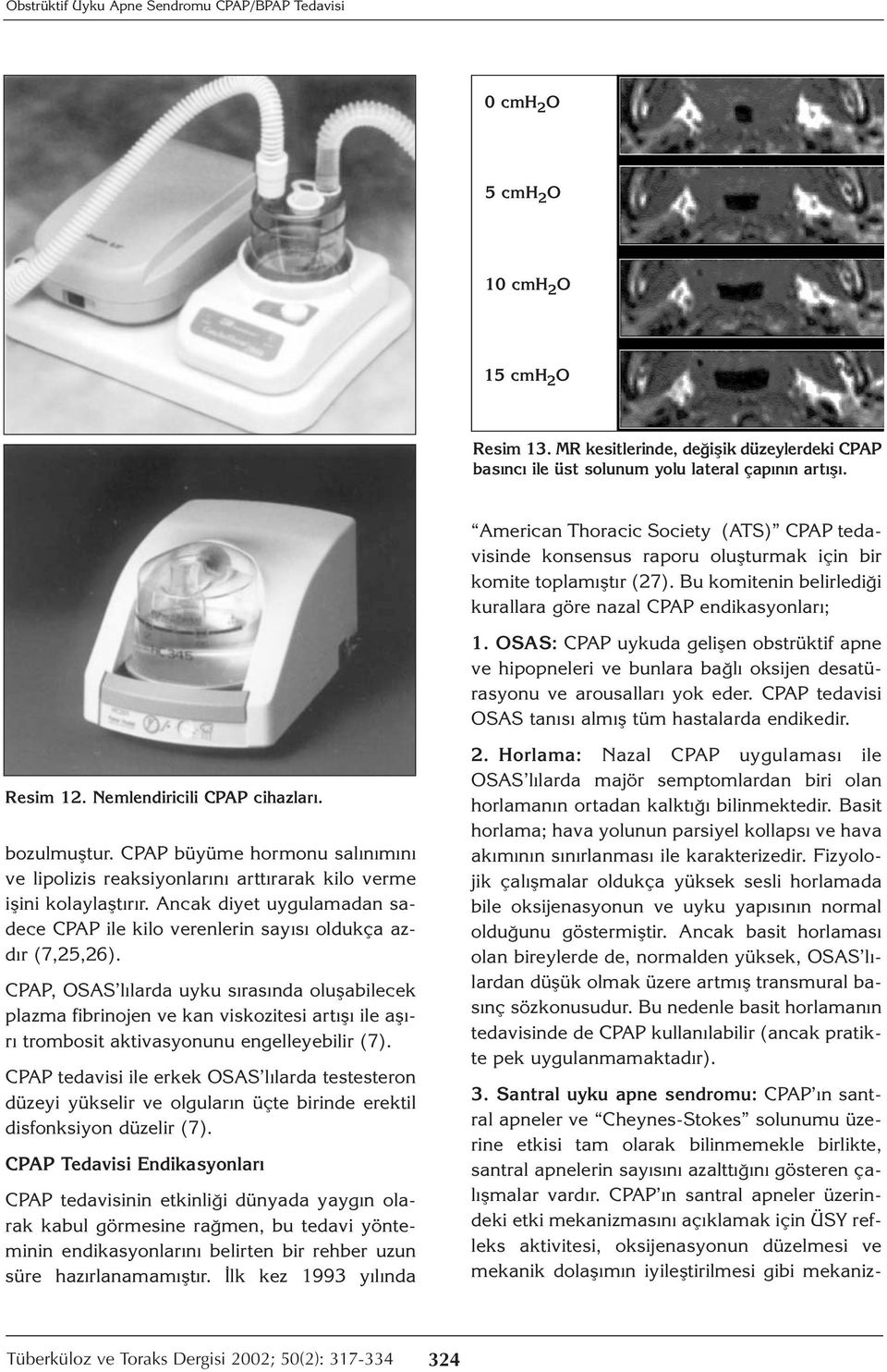 OSAS: CPAP uykuda gelişen obstrüktif apne ve hipopneleri ve bunlara bağlı oksijen desatürasyonu ve arousalları yok eder. CPAP tedavisi OSAS tanısı almış tüm hastalarda endikedir. Resim 12.