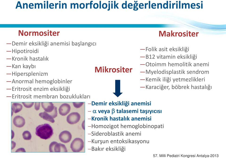 β talasemi taşıyıcısı Kronik hastalık anemisi Homozigot hemoglobinopati Sideroblastik anemi Kurşun entoksikasyonu Bakır eksikliği