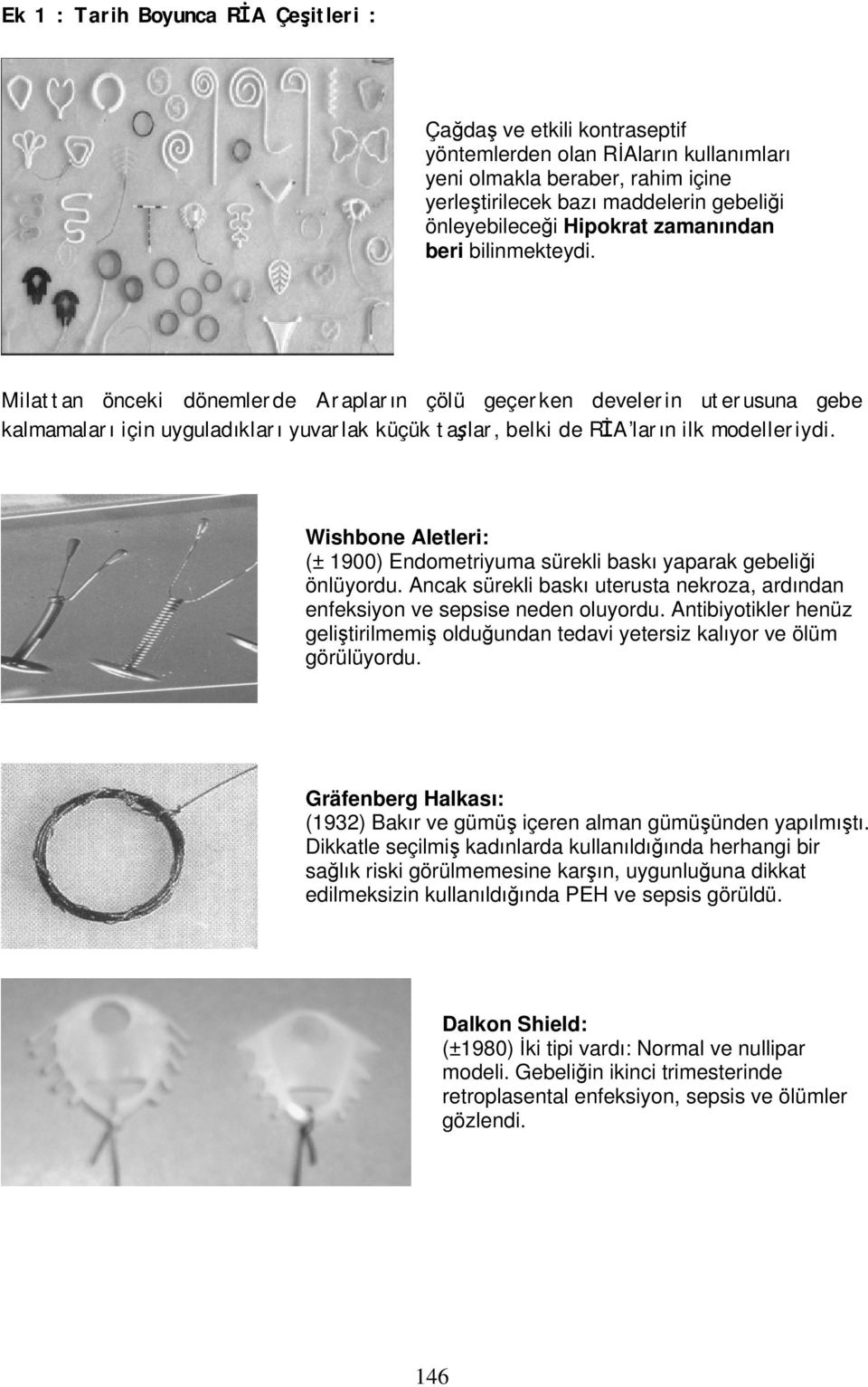 Milattan önceki dönemlerde Arapların çölü geçerken develerin uterusuna gebe kalmamaları için uyguladıkları yuvarlak küçük taşlar, belki de RİA ların ilk modelleriydi.