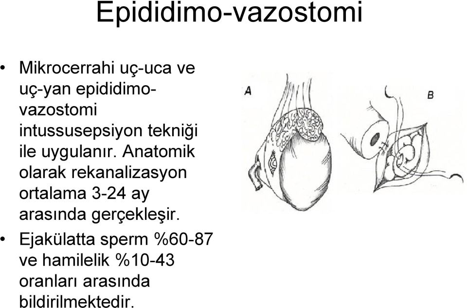 Anatomik olarak rekanalizasyon ortalama 3-24 ay arasında