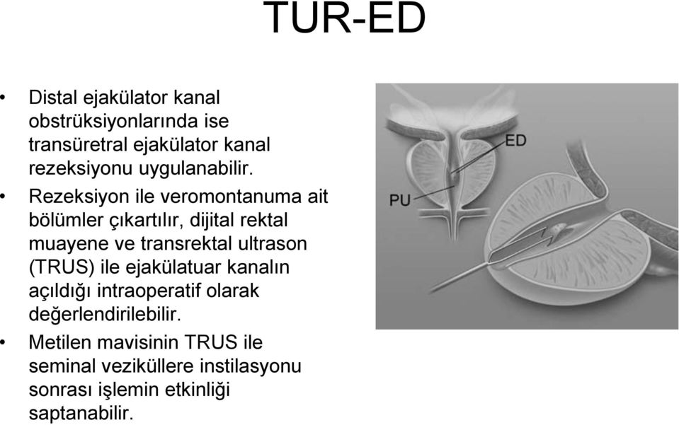 Rezeksiyon ile veromontanuma ait bölümler çıkartılır, dijital rektal muayene ve transrektal