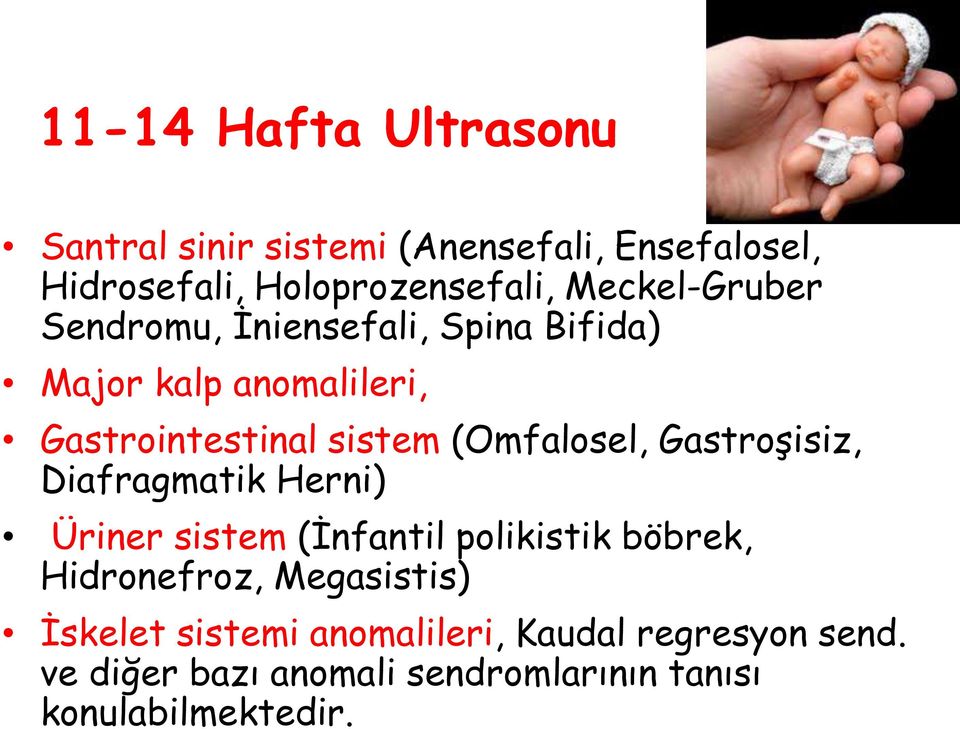 (Omfalosel, Gastroşisiz, Diafragmatik Herni) Üriner sistem (İnfantil polikistik böbrek, Hidronefroz,