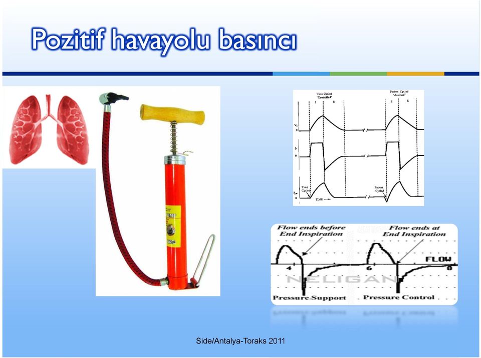 basıncı