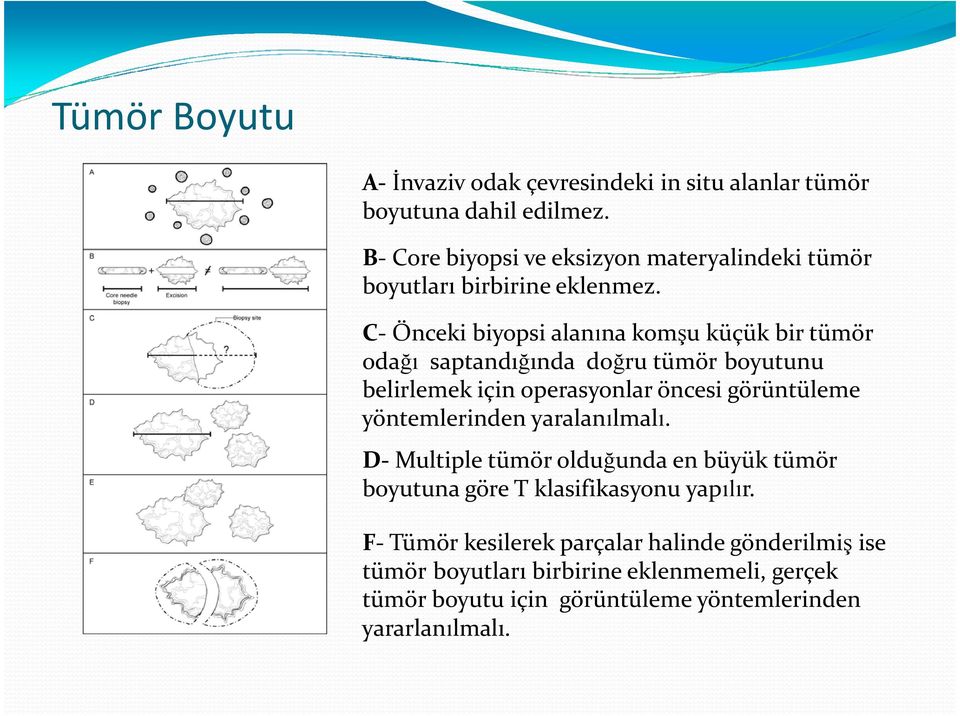 C- Önceki biyopsi alanına komşu küçük bir tümör odağı saptandığında doğru tümör boyutunu belirlemek için operasyonlar öncesi görüntüleme