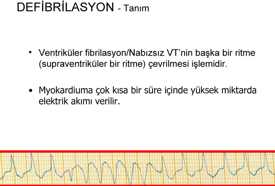 (supraventriküler bir ritme) çevrilmesi işlemidir.