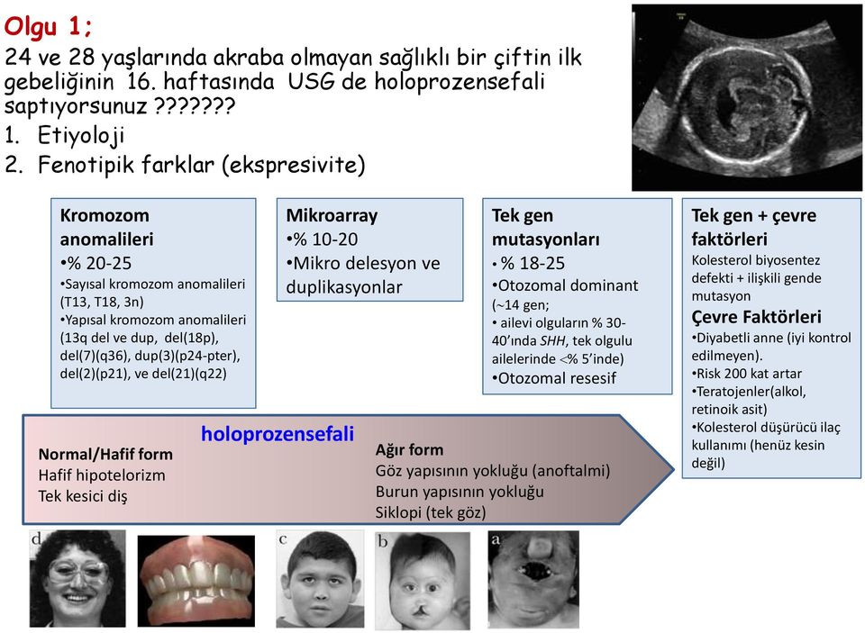 del(2)(p21), ve del(21)(q22) Normal/Hafif form Hafif hipotelorizm Tek kesici diş holoprozensefali Mikroarray % 10-20 Mikro delesyon ve duplikasyonlar Tek gen mutasyonları % 18-25 Otozomal dominant (