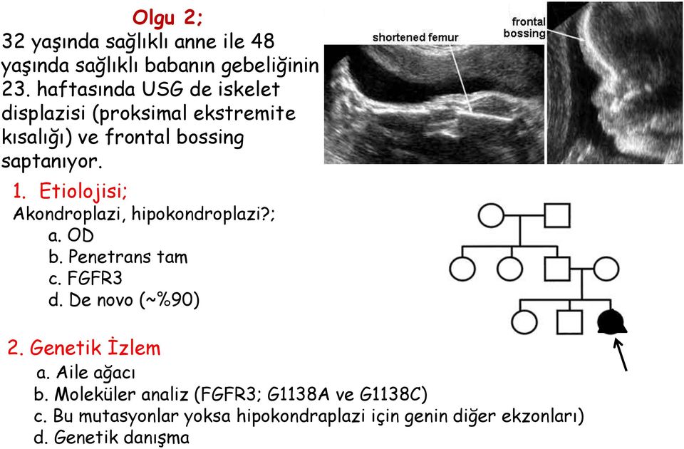 Etiolojisi; Akondroplazi, hipokondroplazi?; a. OD b. Penetrans tam c. FGFR3 d. De novo (~%90) 2.