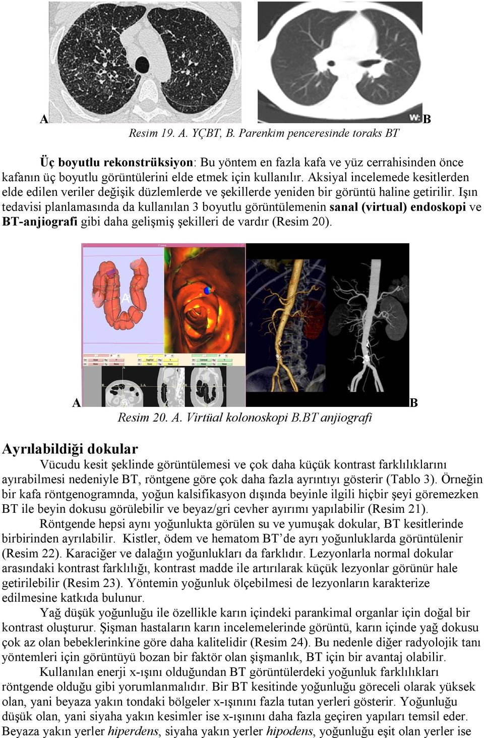 Işın tedavisi planlamasında da kullanılan 3 boyutlu görüntülemenin sanal (virtual) endoskopi ve T-anjiografi gibi daha gelişmiş şekilleri de vardır (Resim 20). Resim 20.. Virtüal kolonoskopi.