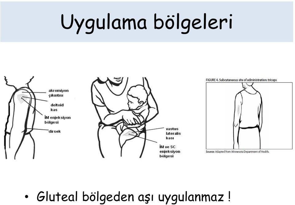 Gluteal