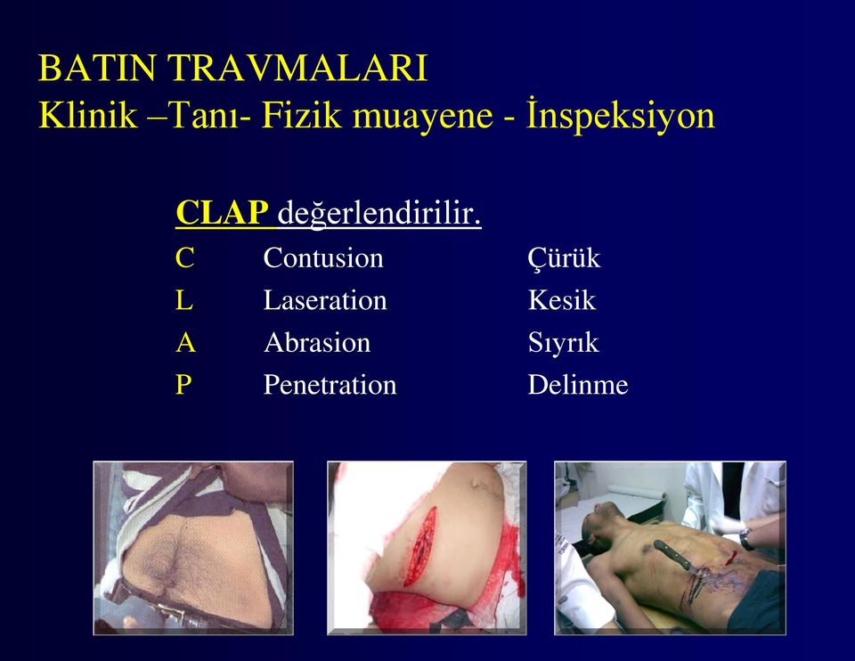 C Contusion Çürük L Laseration