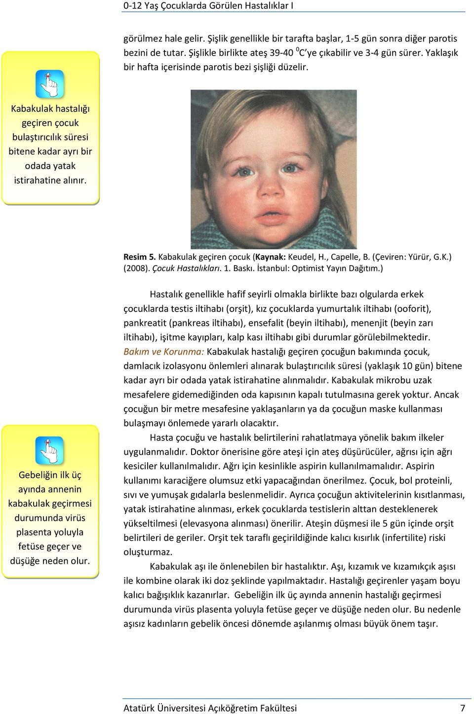 Kabakulak geçiren çocuk (Kaynak: Keudel, H., Capelle, B. (Çeviren: Yürür, G.K.) (2008). Çocuk Hastalıkları. 1. Baskı. İstanbul: Optimist Yayın Dağıtım.
