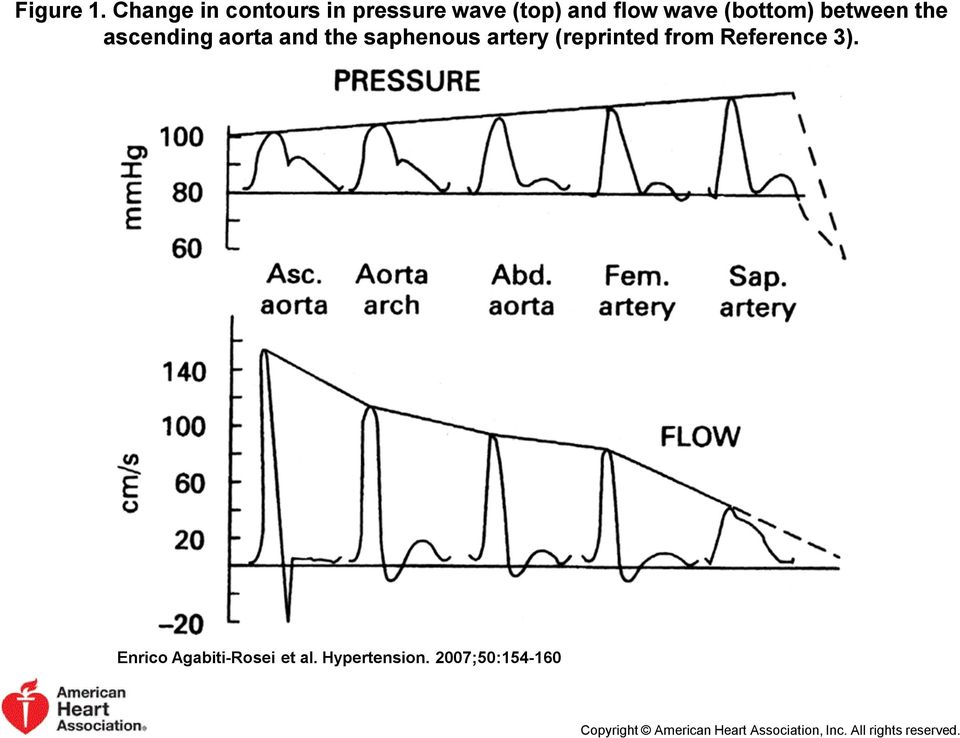 between the ascending aorta and the saphenous artery (reprinted from