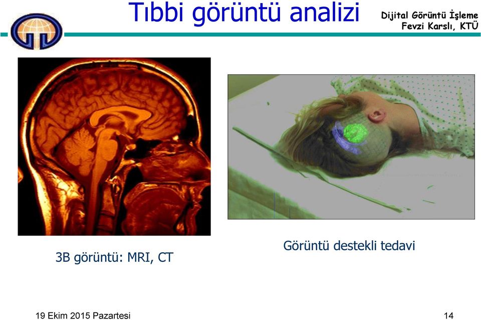 Görüntü destekli