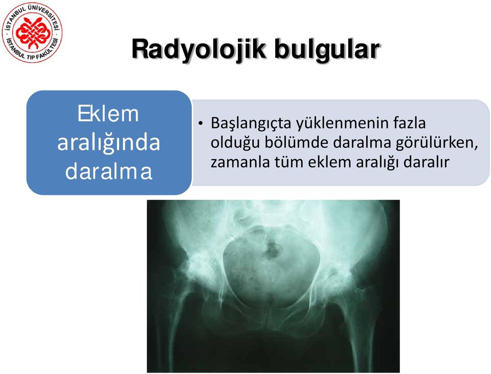 yüklenmenin fazla olduğu bölümde