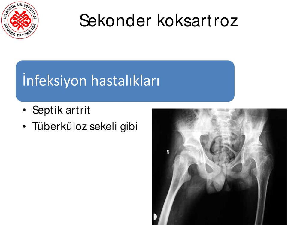 hastalıkları Septik