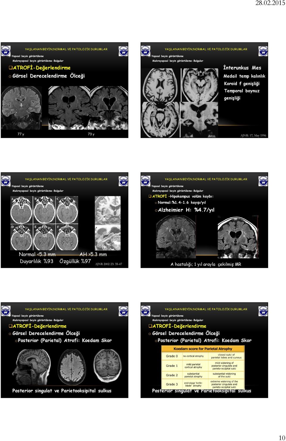 3 mm Duyarlılık %93 Özgüllük %97 AJNR 2002 23: 35-47 A hastalığı; 1 yıl arayla çekilmiş MR oposterior (Parietal) Atrofi: