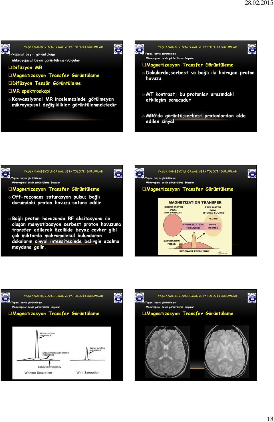 Magnetizasyon Transfer Görüntüleme o Off-rezonans saturasyon pulsu; bağlı durumdaki proton havuzu sature edilir Magnetizasyon Transfer Görüntüleme o Bağlı proton havuzunda RF eksitasyonu ile oluşan
