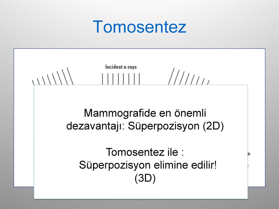 Süperpozisyon (2D) Tomosentez