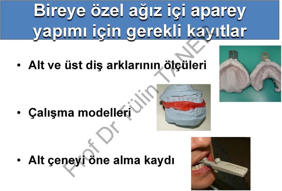 ve üst diş arklarının ölçüleri