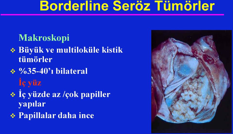 %35-40 ı bilateral İç yüz İç yüzde az