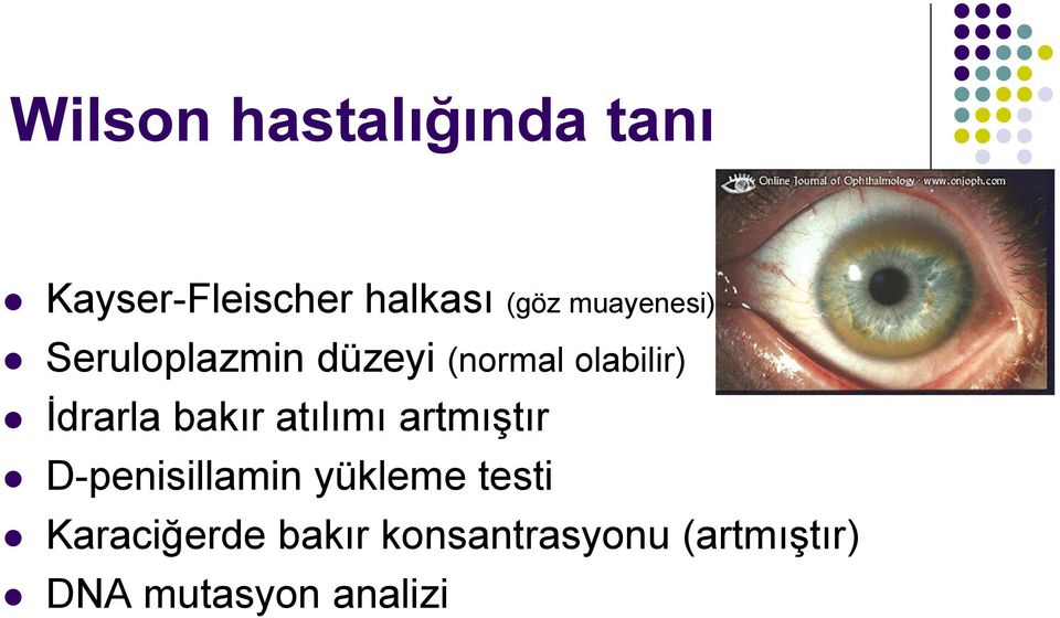 bakır atılımı artmıştır D-penisillamin yükleme testi