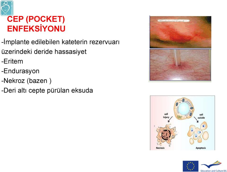 üzerindeki deride hassasiyet -Eritem