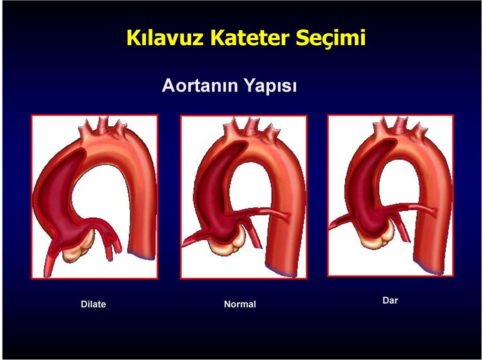 Seçimi