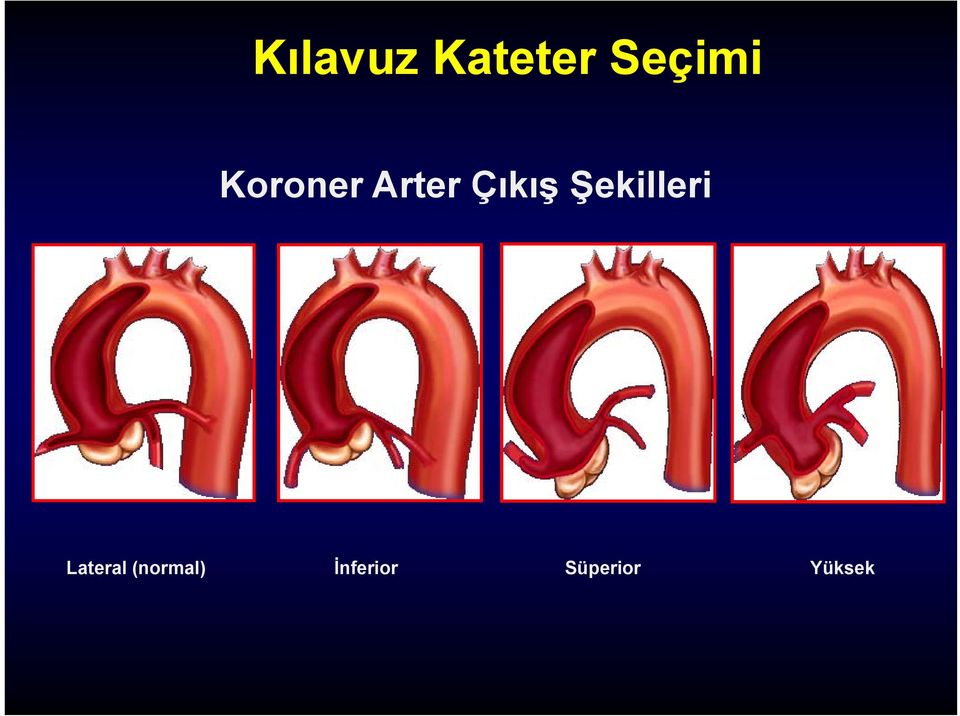 Şekilleri Lateral