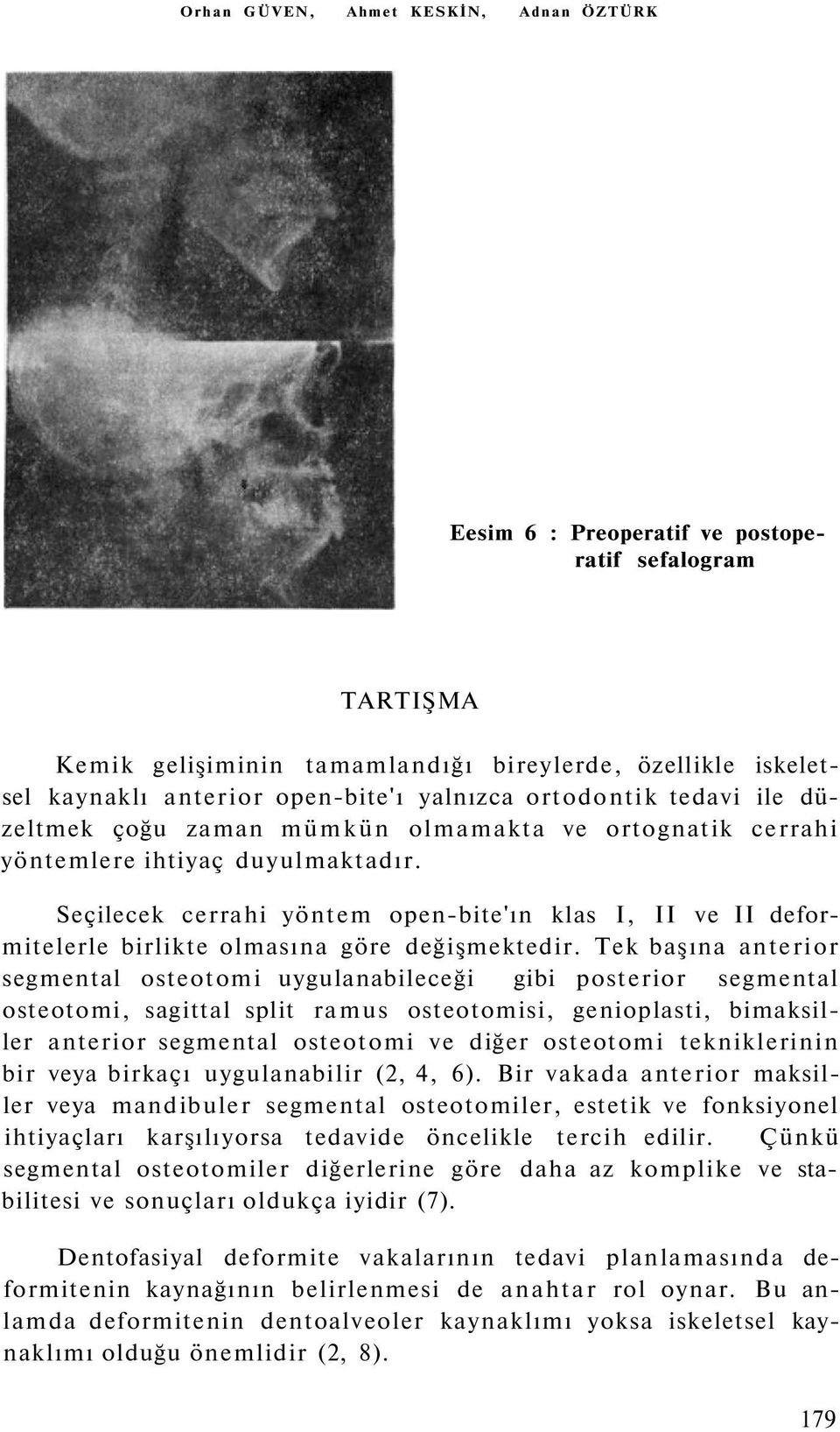 Seçilecek cerrahi yöntem open-bite'ın klas I, II ve II deformitelerle birlikte olmasına göre değişmektedir.