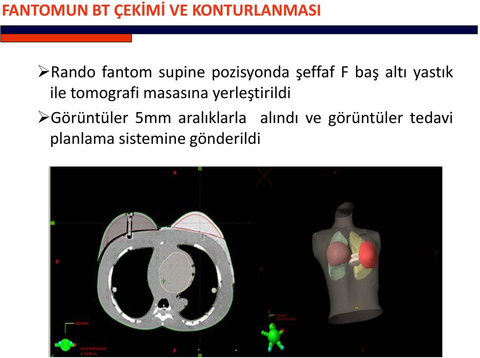 tomografi masasına yerleştirildi Görüntüler 5mm