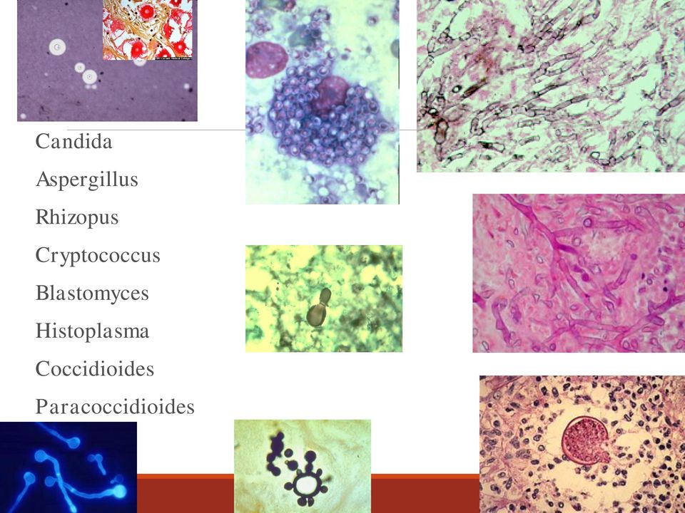 Blastomyces Histoplasma