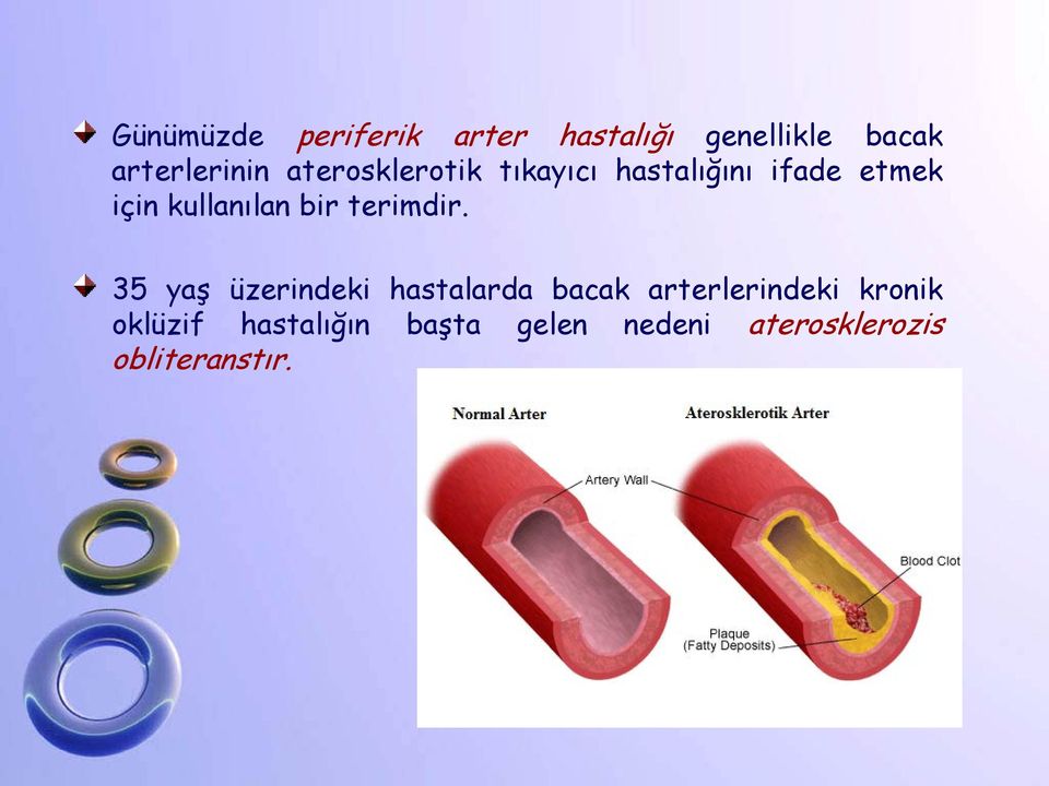 bir terimdir.