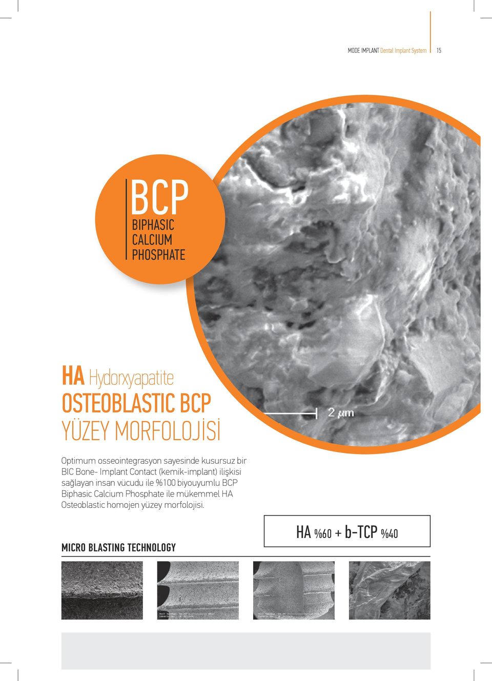 (kemikimplant) ilişkisi sağlayan insan vücudu ile %100 biyouyumlu BCP Biphasic Calcium