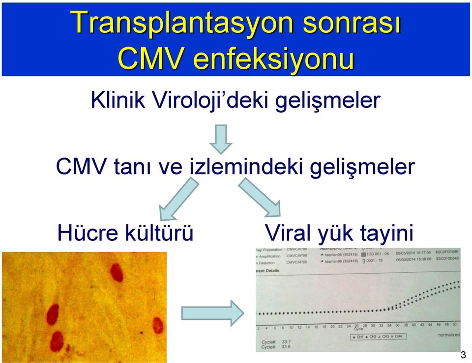 gelişmeler CMV tanı ve izlemindeki