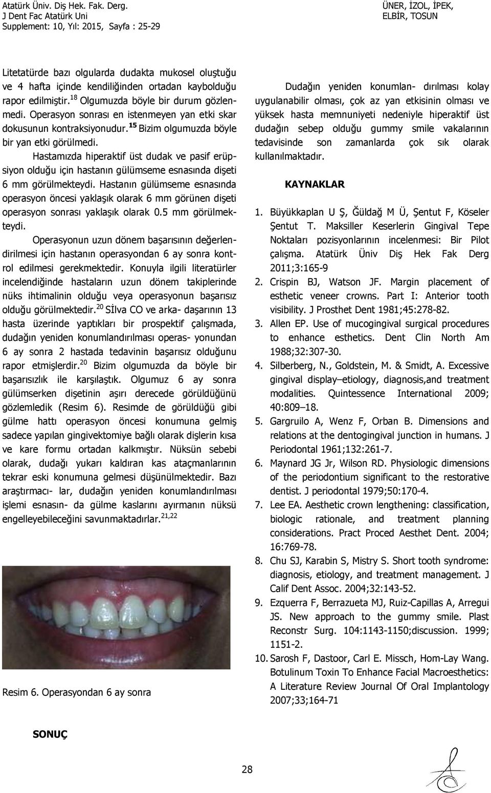 Hastamızda hiperaktif üst dudak ve pasif erüpsiyon olduğu için hastanın gülümseme esnasında dişeti 6 mm görülmekteydi.
