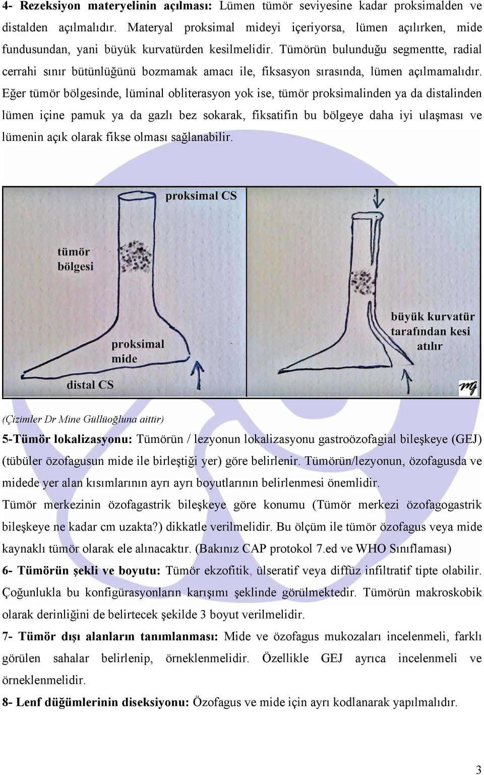 Tümörün bulunduğu segmentte, radial cerrahi sınır bütünlüğünü bozmamak amacı ile, fiksasyon sırasında, lümen açılmamalıdır.