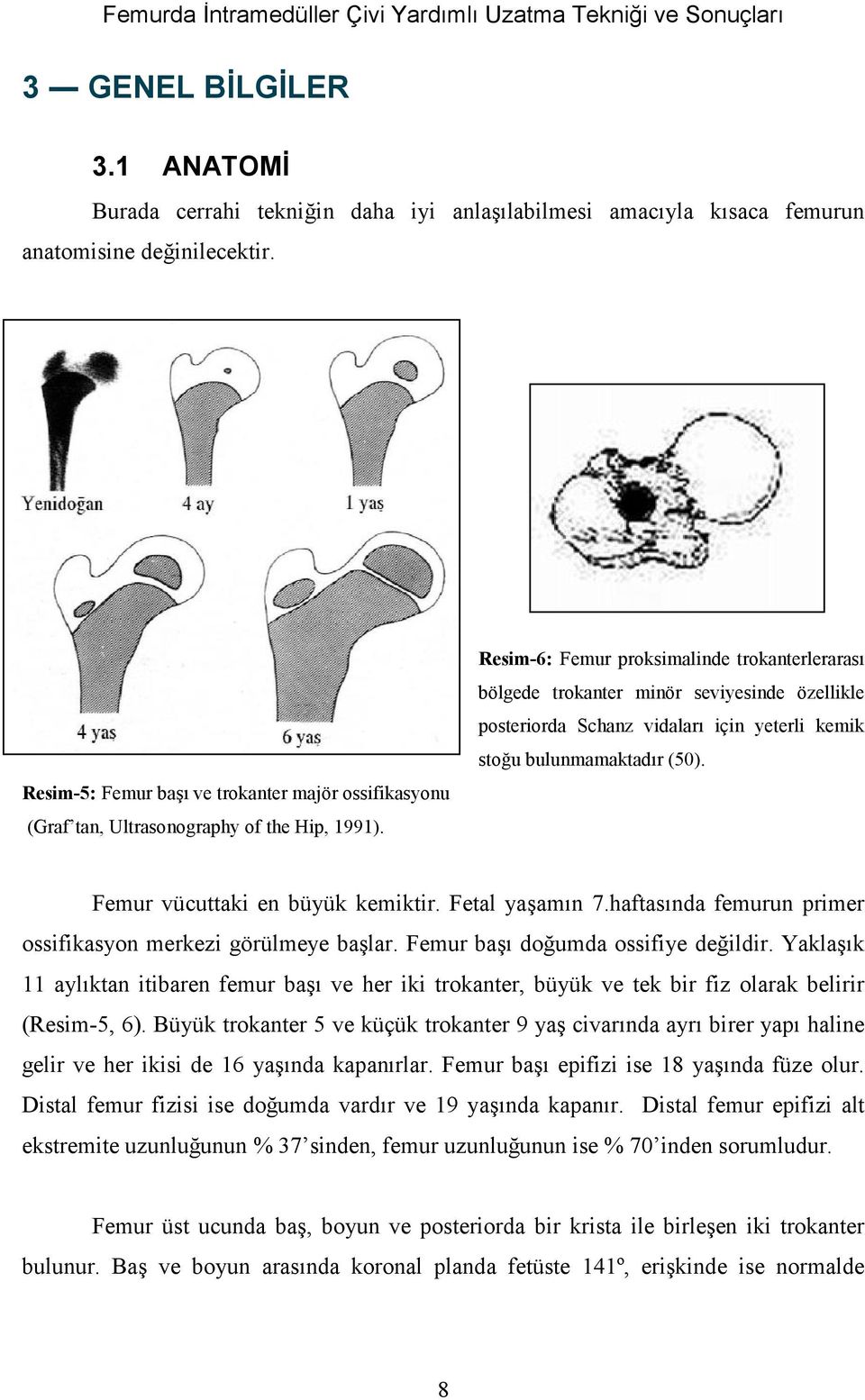 Resim-6: Femur proksimalinde trokanterlerarasù bölgede trokanter minör seviyesinde özellikle posteriorda Schanz vidalarù için yeterli kemik stoğu bulunmamaktadùr (50).
