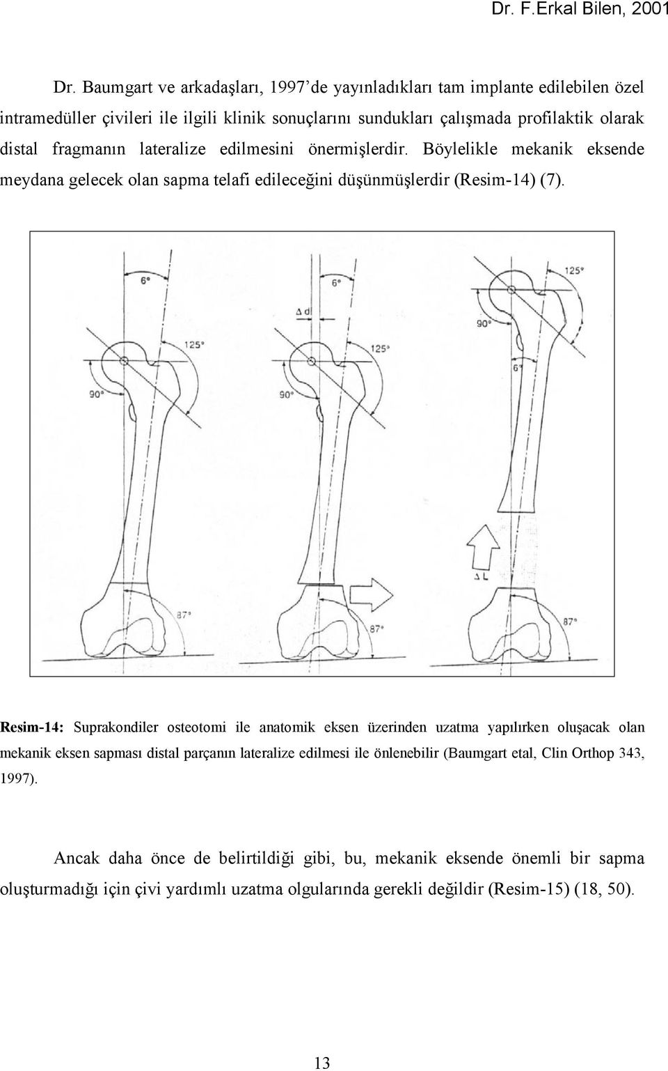 fragmanùn lateralize edilmesini önermişlerdir. Böylelikle mekanik eksende meydana gelecek olan sapma telafi edileceğini düşünmüşlerdir (Resim-14) (7).