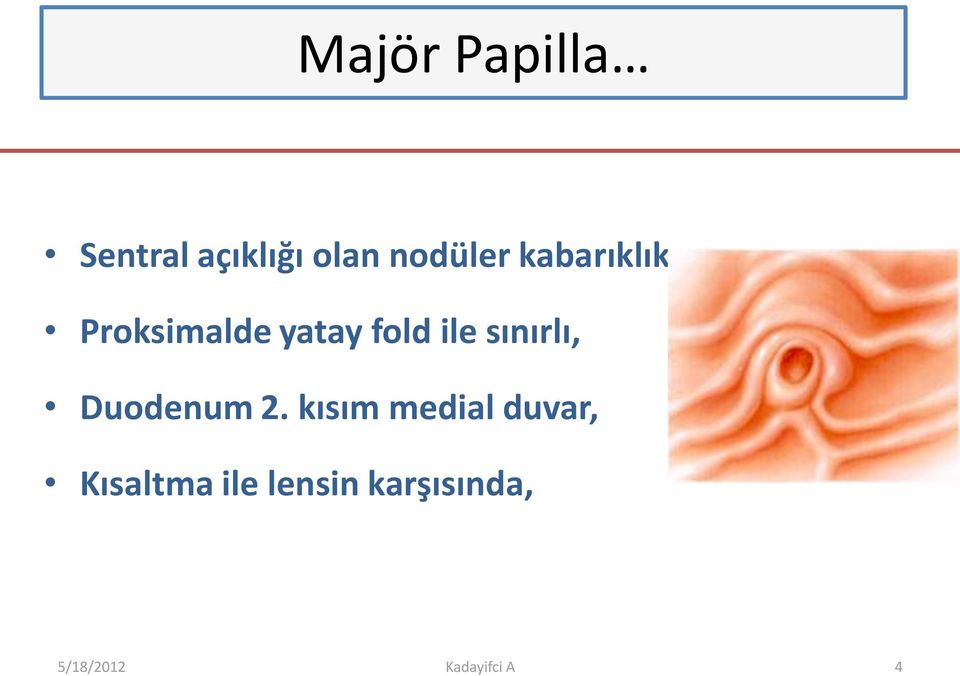 sınırlı, Duodenum 2.