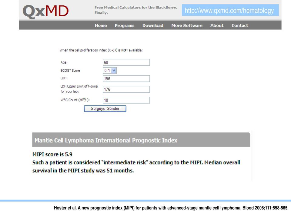 A new prognostic index (MIPI) for