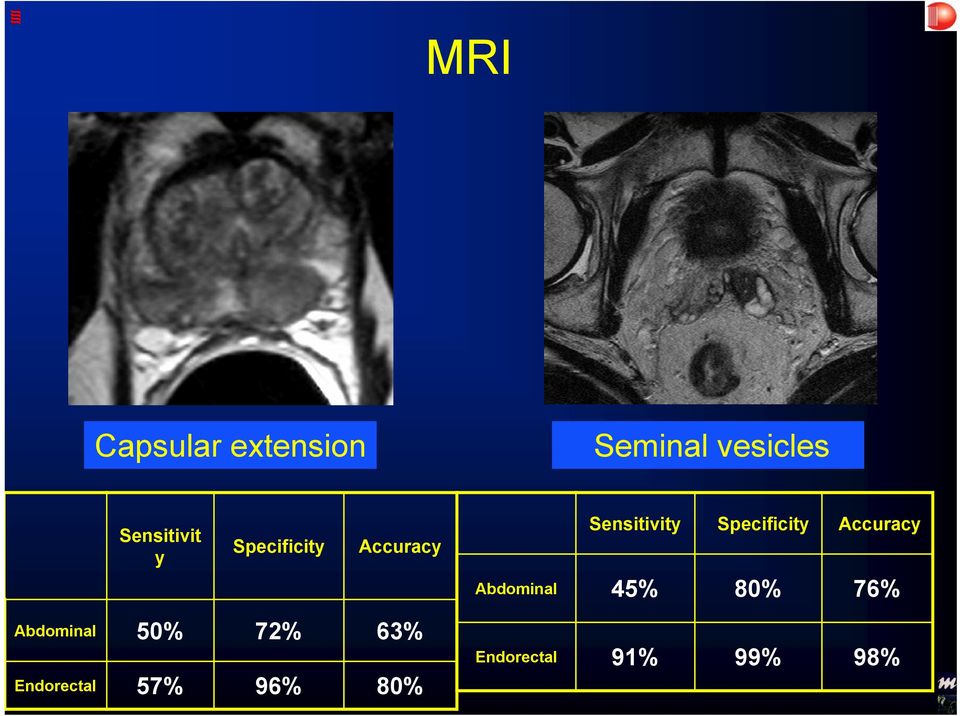 Specificity Accuracy Abdominal 45% 80% 76%