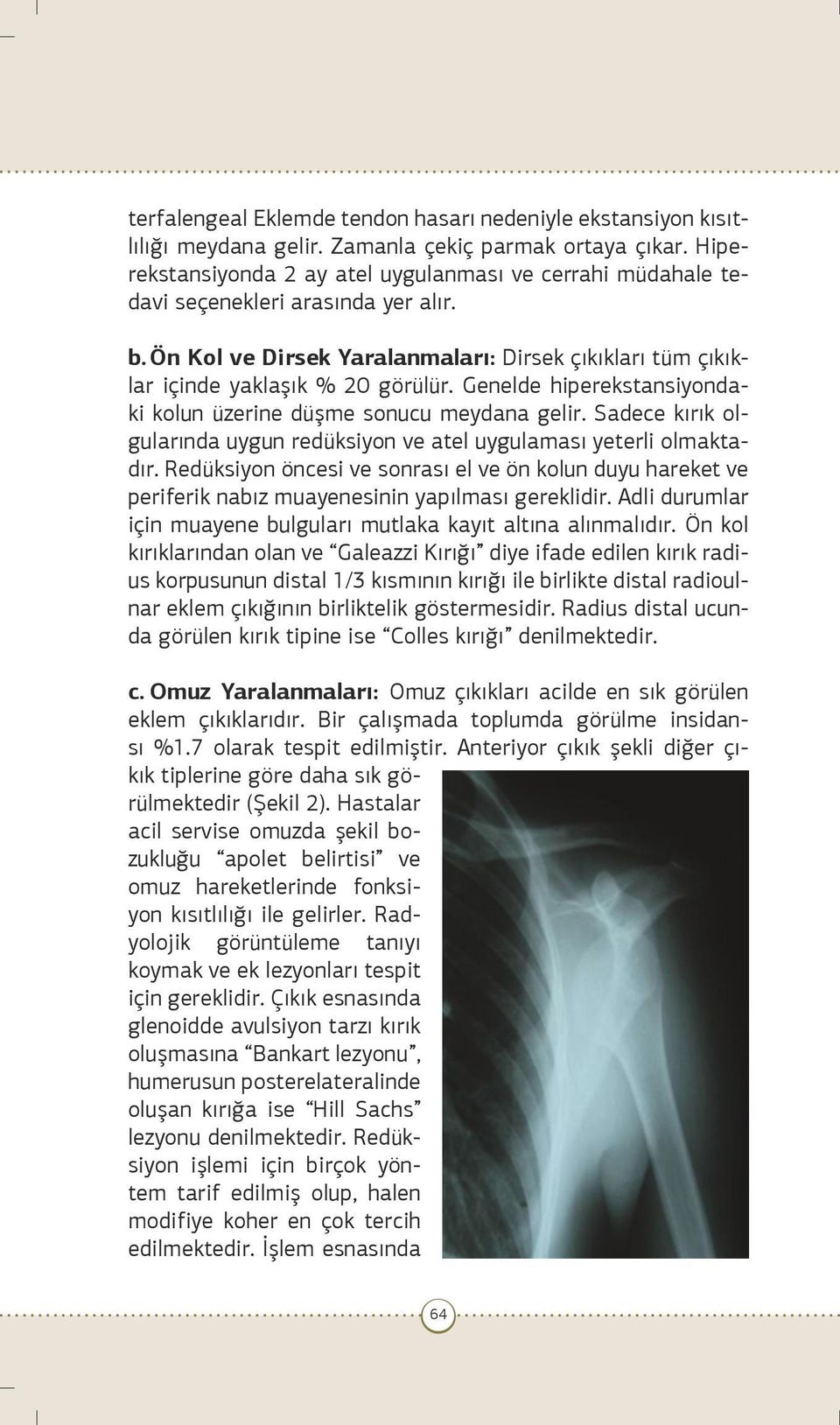 Genelde hiperekstansiyondaki kolun üzerine düşme sonucu meydana gelir. Sadece kırık olgularında uygun redüksiyon ve atel uygulaması yeterli olmaktadır.