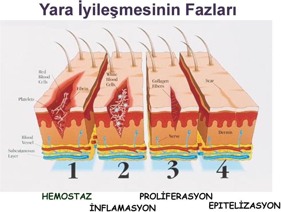 PROLİFERASYON