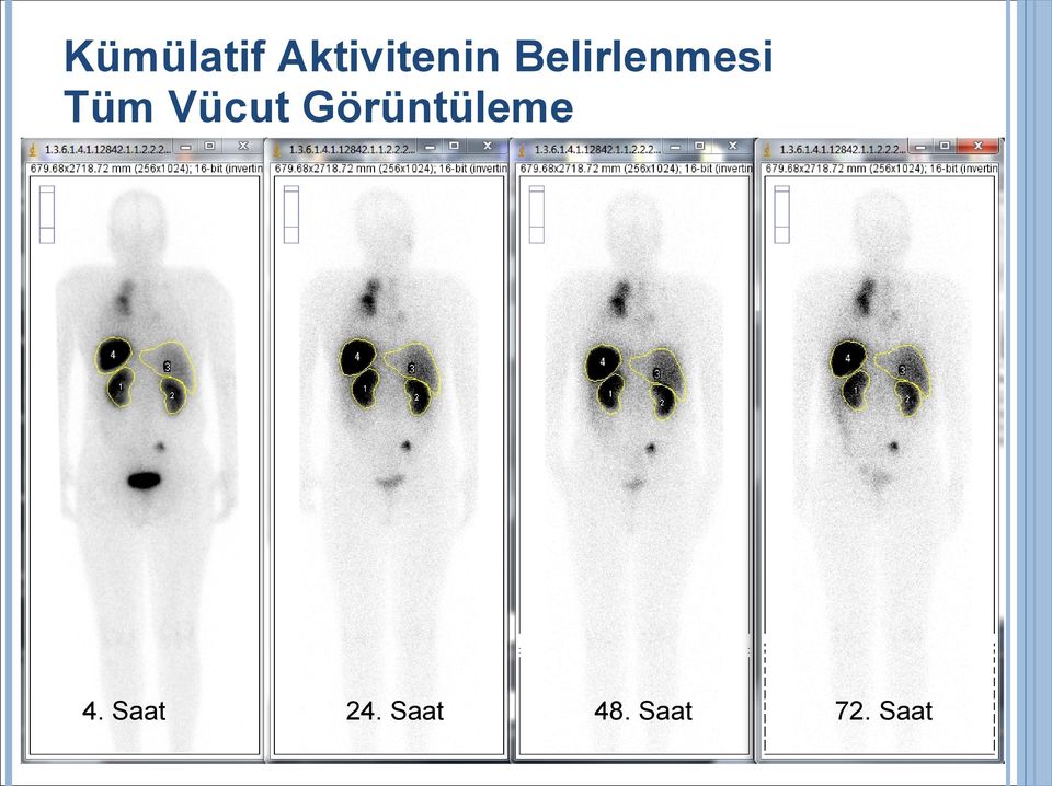 Görüntüleme 4. Saat 24.