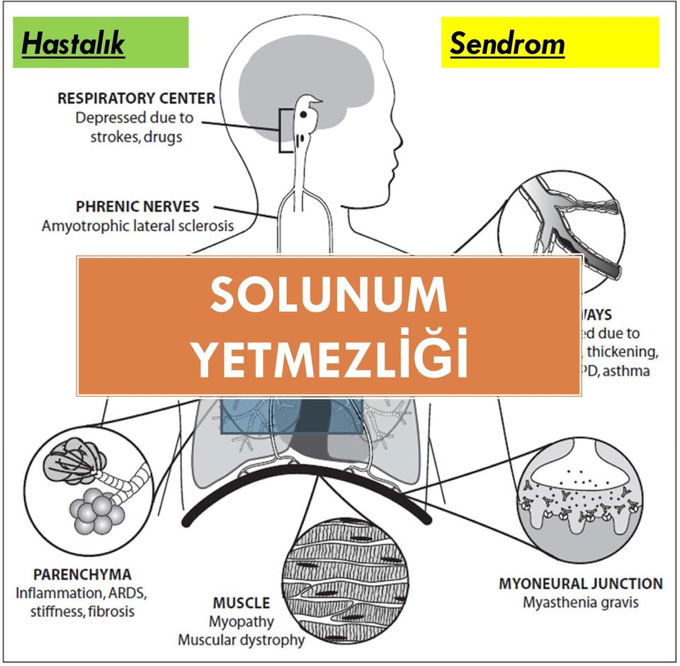 SOLUNUM