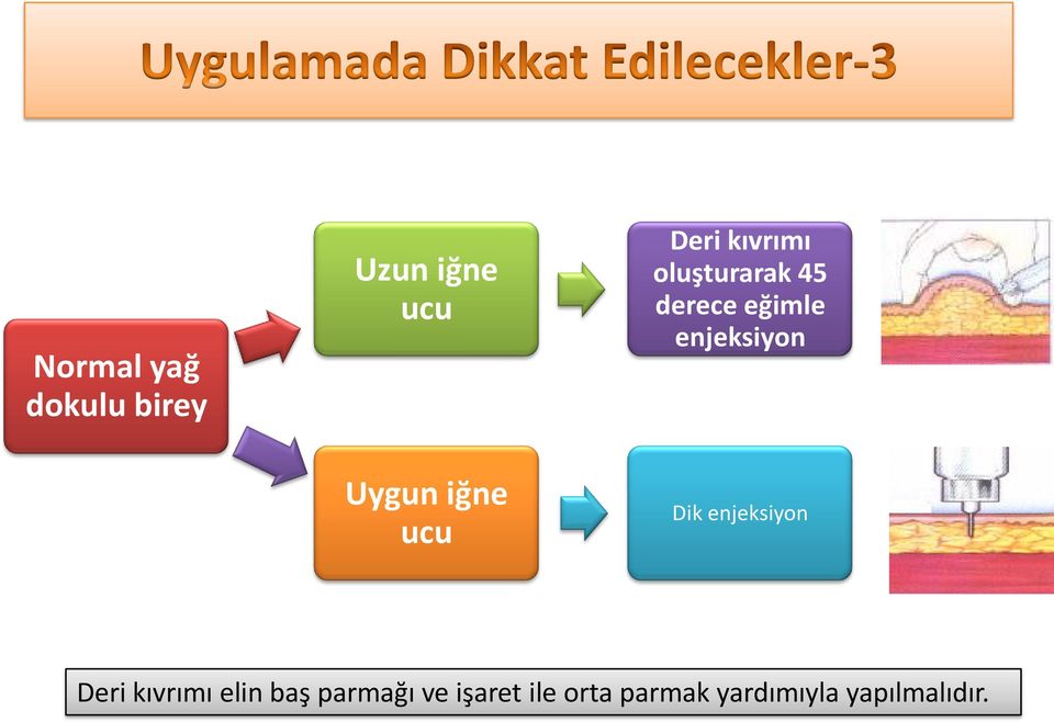 enjeksiyon Uygun iğne ucu Dik enjeksiyon Deri kıvrımı