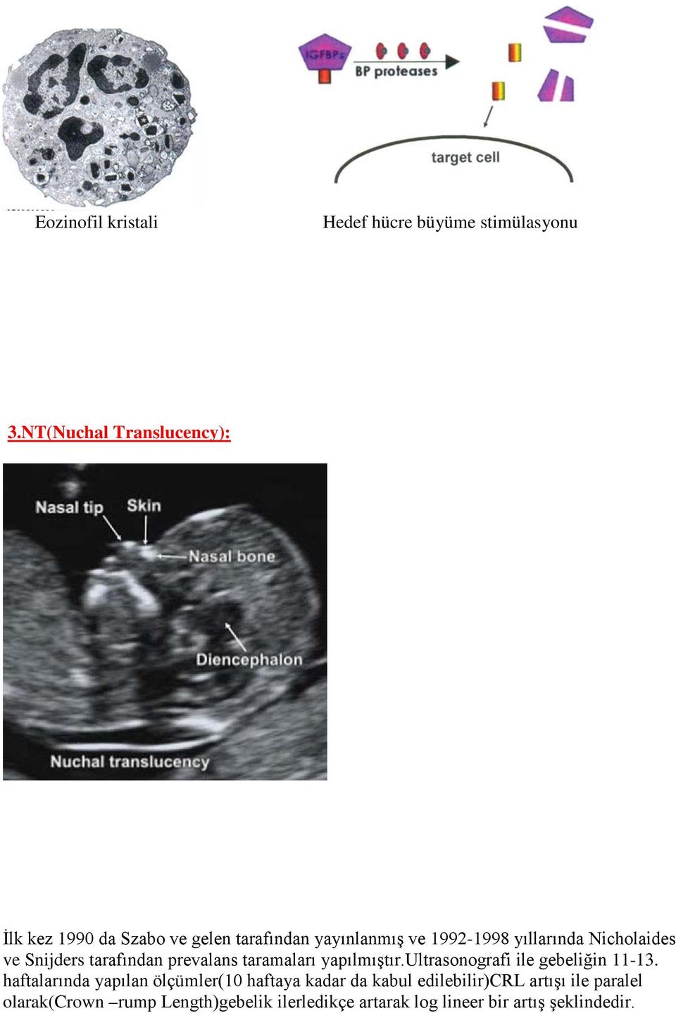Nicholaides ve Snijders tarafından prevalans taramaları yapılmıştır.ultrasonografi ile gebeliğin 11-13.