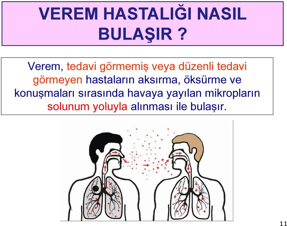 görmeyen hastaların aksırma, öksürme ve