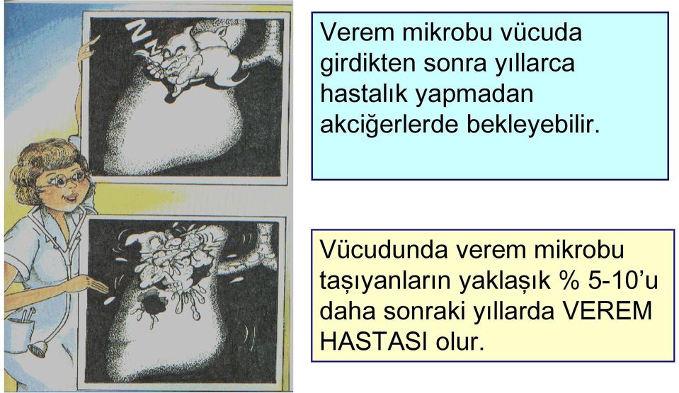 Vücudunda verem mikrobu taşıyanların yaklaşık